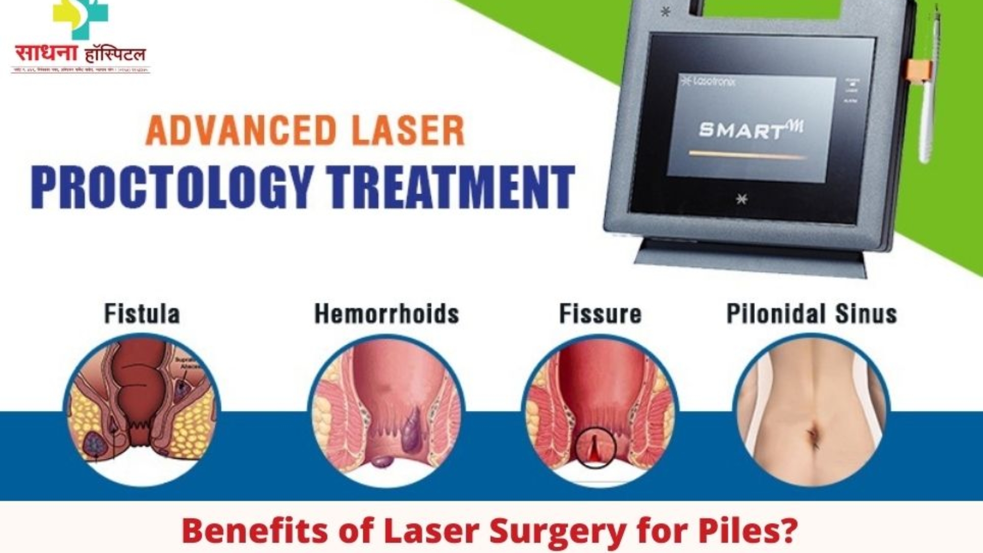 Act on Cotaract Before it's too Late (5)